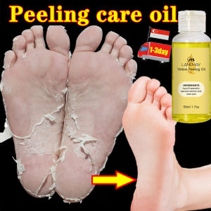 Yellow-Peeling Oil Exfoliating peeling butter Whitening and brightening skin oil peeling care oil for Cracked foot hand  Dry skin Whitening