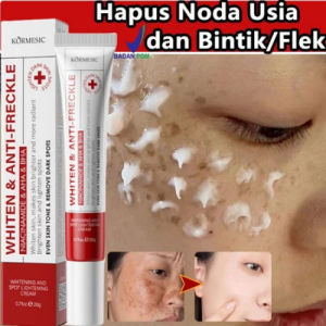 Cream Flek Hitam Membandel BPOM 20g Whiten & anti-freckle Whitening Cream Membandel Niacinamide cream Siang Malam salep flek hitam Whitening Freckle Cream Perbaikan bekas luka Niacin Dark Spots Removal Brightening