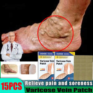 Miếng Dán Giãn Tĩnh Mạch Chân Cao Cấp - Hỗ Trợ Lưu Thông Máu Giảm Nặng Chân & Chuột Rút