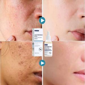 EELHOE Hyaluronic Acid Face Serum Whitening Anti-Aging Anti-Wrinkle Shrink Pores Moisturizing Essence Face Dry Skin Care Repair -Serum Glowing -Serum Wajah -Glowing Skin - Serum Peemutih Wajah Glowing 30ML