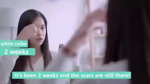 Dermatix Scar Gel Acne Scars Treatment Scar Removal Cream Acne Scar Remover 7g FOR KIDS & FOR S