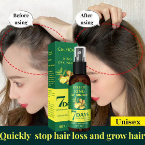 Penumbuh Rambut Cepat Hair Growth Spray PENUMBUH RAMBUT Cairan Serum Penumbuh Rambut Anti Rontok / Obat rambut botak / serum penumbuh rambut botak / penumbuh rambut botak / obat penumbuh rambut botak pria / rambut rontok parah / rambut rontok penyubur