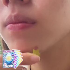 All-Round Acne Treatment: OUHOE Cute Colorful Acne Patches