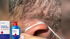 Selenium Sulfide Shampoo Anti-Dandruff & Itch Relief Gentle Scalp Cleanser Smooth & Volumizing