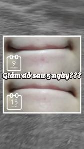 Serum Mediheal Hỗ Trợ Cấp Ẩm Phục Hồi Da 40ml