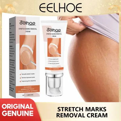 Eelhoe Stretch Mark Removal Cream Treatment Scars Acne Stretch Marks Remove Postpartum Anti Wrinkle Pregnancy Mark Remove Cream Anti Aging Wrinkles Repair Maternity Stretch Mark Scars Acne Smooth Skin Cream