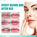 South Moon Lip Lightening Liquid Whitening Cream Pink Lips Nourish Protect Hydrated Maintenance Herbal Lip Balm Lip Care Beauty Makeup Remedy Lightening Cream Brighten Lip Color Peeling Lip Balm For Repairing Lip Line Hydrating Lip Products Overnight. 