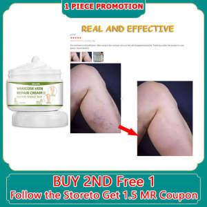 varicose veins treatment cream 靜脈曲張治疗蜘蛛静脉腿部护理 veins leg numb cream 50g Effective Remover Cream Spider Vein Pain Killer Cream Relieve promoting blood circulation expansion and unblocking blood vessels