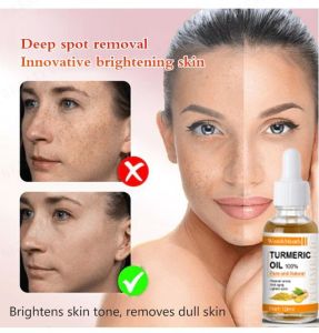 greatfunny 【1/2PCS】Brightening Skin Turmeric Serum