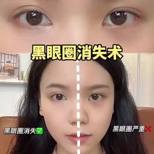 Dorisna 3 Color Concealer Palette Full Coverage Foundation Cream Matte Waterproof Natural Makeupnew arrival