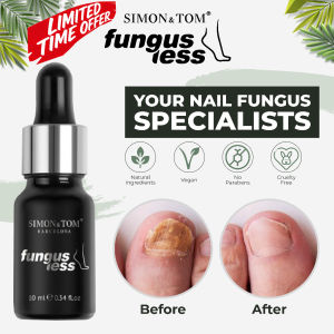 [Limited-time flash sale]Simon& Tom fungusless nail treatment. SG stock exp2027