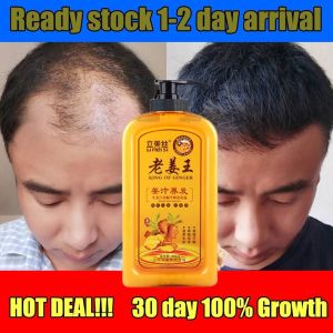 GXY 500ML Ginger Hair Shampoo Fast Regrowth Hair Thick Anti-Hair Loss Anti-Dandruff Anti-itching Shampoo