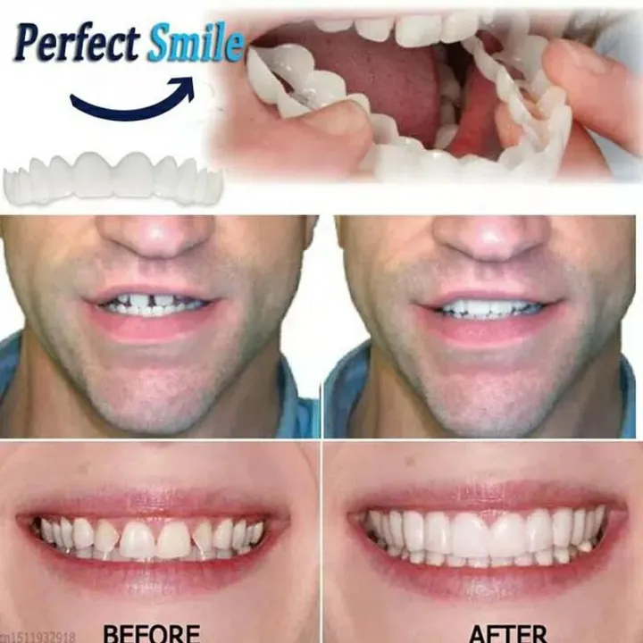 Snap%20On%20Smile%20Gigi%20Palsu%20Instant%20Tinggal%20Pasang%201%20Set%20Atas%20dan%20Bawah%20-%20Image%206