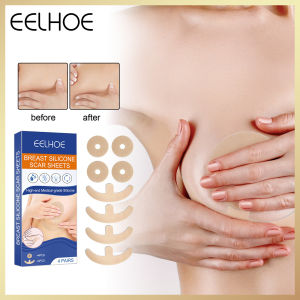 Eelโฮแผ่นปิดแผลเป็นซิลิโคนเต้านมแผ่นปิดแผลเป็นจากการผ่าตัดเต้านมแผ่นซ่อมรอยแผลเป็นที่มีประสิทธิภาพแผ่นสติกเกอร์ปิดแผลเป็นเพื่อสุขภาพสำหรับผู้หญิง (4คู่)