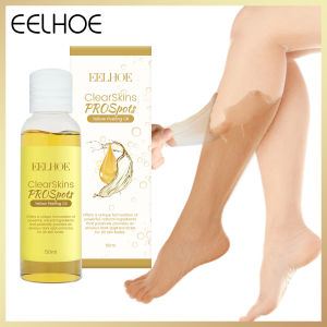 EELHOE Exfoliating Oil Dark Skin Spots Blackheads Blemishes Skin Spot Whitening Peeling Oil Dark Skin Spot Blackheads Blemishes Skin Whitening Peeling Cream Dark Spots On Body Yellow Peeling Oil With Hyaluronic