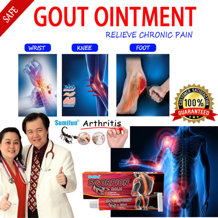 gout ointment cream original by willie ong gout treatment cream ...