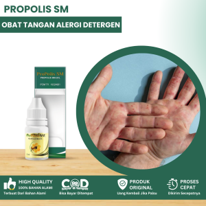 Obat Gatal Alergi Deterjen Alergi Pada Kulit Obat Gatal Di Telapak Tangan Obat Kulit Kering Mengelupas Alergi Sabun Detergen Obat Kulit Sensitif Iritasi Kulit Dengan Propolis SM