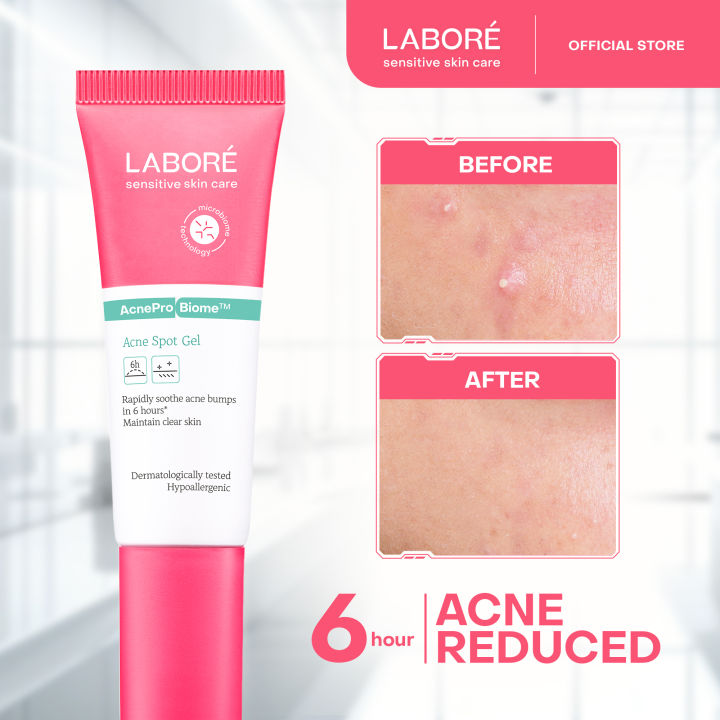 %5BGift%20Not%20For%20Sale%5D%20LABORE%20Sensitive%20Skin%20Care%20Acne%20Spot%20Gel%2015%20ml%20-%20Image%202