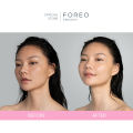 Máy rửa mặt FOREO LUNA 3 dành cho da hỗn hợp, có thể sạc, bảo hành 2 năm, theo dõi bằng APP - intl. 