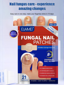 Ingrown Nail Repair Patch Patch Nail Positive Glue Free Nail Groove Antibacterial Nail Repair Patch