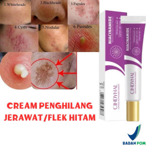 Cream Penghilang Flek Hitam Whitening Freckle Cream Krim Bintik Melasma Mencerahkan Kulit Efektif Menghilangkan Bintik Hitam