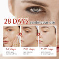 EELHOE Pigment Correcting Cream Freckles Removal Cream Pigment Correcting Serum Remove Melasma Age Spots Sunspots Whitening Freckle Removing Cream Effective Brightening Essence Remove Pigment Melanin Correct Beauty Facial Skin Care. 