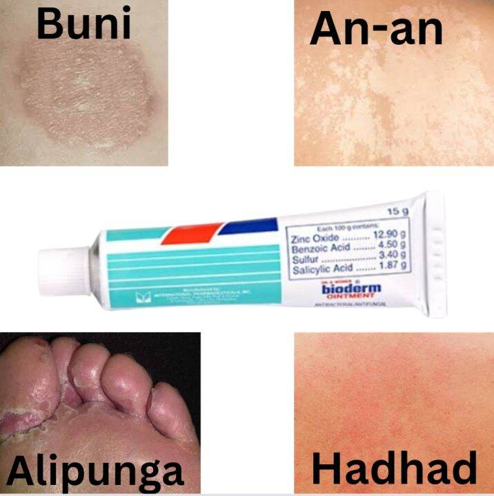 Anti-fungal Cream: Gamot sa An-an, Buni, Hadhad, Alipunga at iba pa 5g or  15g | Lazada PH