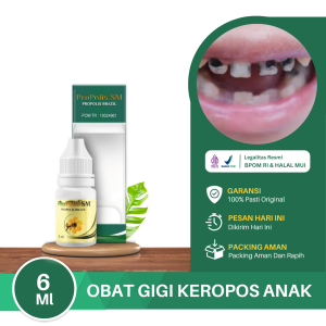 Obat Gigi Keropos Anak Gigi Hitam Karies Gigi Gigi Keropos Sakit Gigi Busuk Gigi Rusak Penghilang Ulat Gigi Gigi Berlubang Gigi Keropos Depan Hitam Dengan PROPOLIS SM