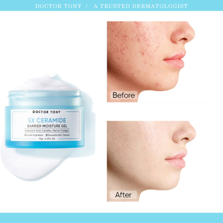 Fac-ial Cream 5x Ceramide Repair Skin Barrier Gel Fade Redness Lock ...