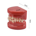 3D Resin Dental Model Teeth Malocclusion Model For Demostration Teaching Dental Students Study Oral Dentistry Products. 