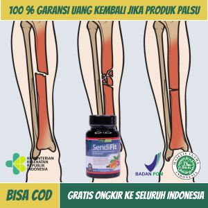 Obat Penyambung Tulang Patah Obat Cedera Tulang Obat Kelainan Tulang Obat Infeksi Tulang Obat Tulang Remuk Obat Pengapuran Tulang Obat Patah Tulang Akibat Jatuh Atau Kecelakaan Dengan Sendifit