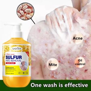 【Mega Sale】🔥🔥防螨瘙痒淋浴500ml痤疮沐浴露sabun jerawat badan hilang jerawat美白沐浴露瘙痒抗菌沐浴露除螨美白防螨止痒祛痘沐浴露