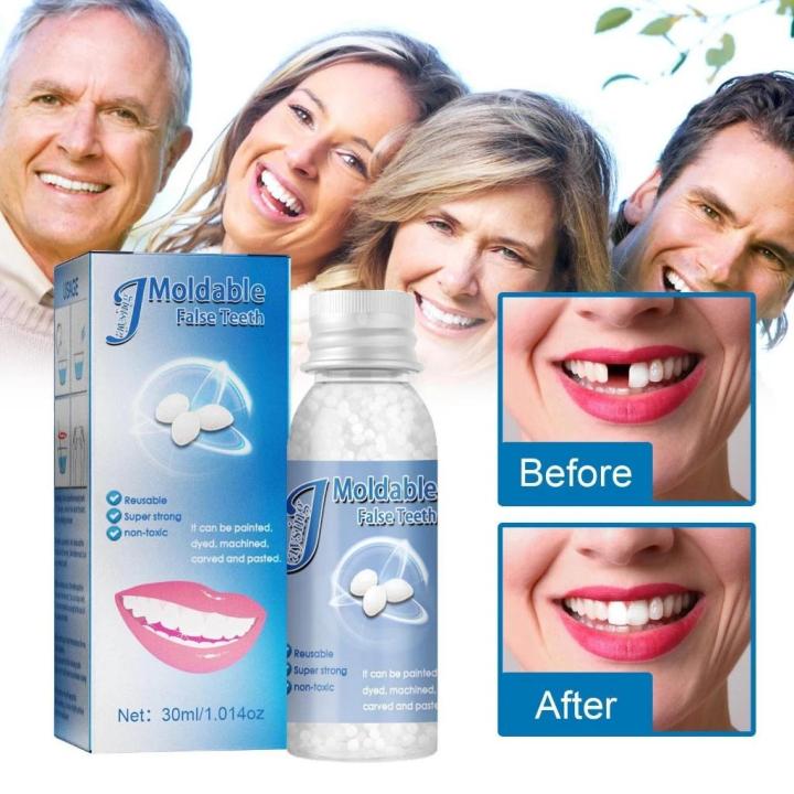 Diy Gigi Palsu Temporary Tooth Repair Kit Teeth And Gaps FalseTeeth And ...
