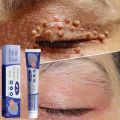 Obat Kutil Paling Ampuh Wart Remover Krim Penghilang Kutil Salep Kutil Penghilang Kutil Wajah Menghilangkan Kutil Filiform. 