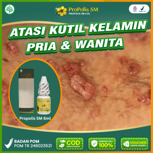 Obat Kutil Kelamin HPV Pria Wanita di Penis Vagina mis v Dubur Daging jadi Selangkangan Propolis