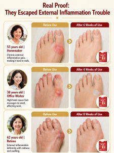 Bunion Patch Gentle Herbal Foot Care Patch Hallux Valgus Toe Support Breathable Bunion Cushion Sticker for Comfortable Daily Wear