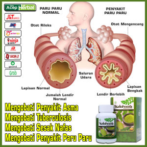 Obat Sesak Nafas Asma TBC Tuberculosis Pneumonia Bronkitis Penyakit Paru Paru Keloreena Isi 50 - 100 Kapsul