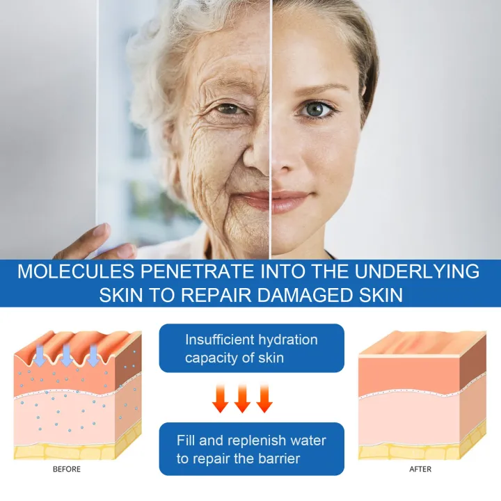 Hoygi%20Facial%20Hydrating%20Serum%20Blue%20Copper%20Peptide%20Solution%20Deep%20Nourish%20Lock%20Water%20Shrink%20Pores%20Brighten%20Skin%20Rejuvenation%20Face%20Essence%20-%20Image%208