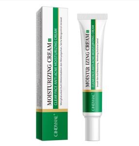 BPOM CINDYNAL Cream Jerawat dan Bekas Jerawat / Moisturize Anti Acne Clear Face Moisturizing Cream / Krim Jerawat Paling Ampuh