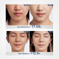 Ulike ReGlow LED Face Mask for Groupsale. 