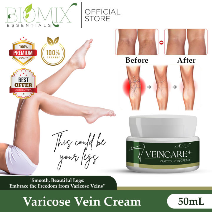 Revitalize Your Legs With Biomix Varicose Vein Cream Fast Acting Formula Lazada Ph