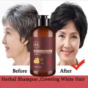 Original Shampoo Uban Menjadi Hitam / Shampoo Uban Permanen Black Herbal Natural Polygonum Multiflorum Hair Blackening - 300ml