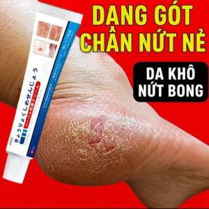 (10 tuýp) Kem dưỡng da chân Chuyên Hắc làonấm ngứa da á sừng lang ben