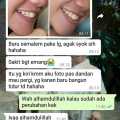 Alat untuk merapihkan gigi maju Alat perapih gigi tonggos original asli Perapih gigi maju ke depan Behel gigi lepas pasang karet murah Perapih gigi tonggos atas asli ginsul atas tidak rata asli Alat buat merapihkan gigi tonggos Teeth Trainer Alignment ORI. 