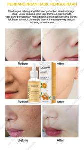 [MOOYAM] GINGER + VITAMIN C SERUM - Mencerahkan Meratakan Warna Kulit & Menyamarkan Flek Hitam 30ml