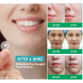 Super Plester Jerawat Acne Pimple Patch 36 PCS Obat Jerawat Wajah. 