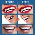 10/20/30G Teeth Solid Glue Denture Filling Solid Gel Denture Adhesive Glue Temporary Tooth Repair Kit Teeth Solid Glue Tooth Replacement  Tools Oral Care. 