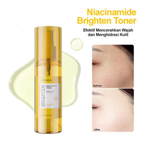 [BPOM] KORMESIC Niacinamide Toner Wajah 90ML / Mencerahkan dan Menyegarkan Kulit Berminyak
