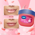 [Bundle] Vaseline Lip Therapy Lip Balm Rosy 7G + Vaseline Rosy Lip Stick 4.8g. 