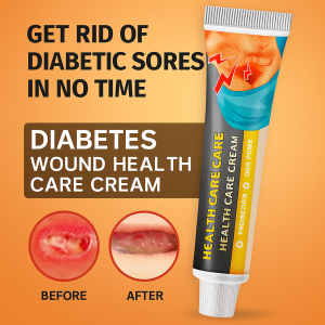 Diabetic Wound Care Cream Repair Cream For The Elderly Moxibustion Wound Care Cream Acne Relief